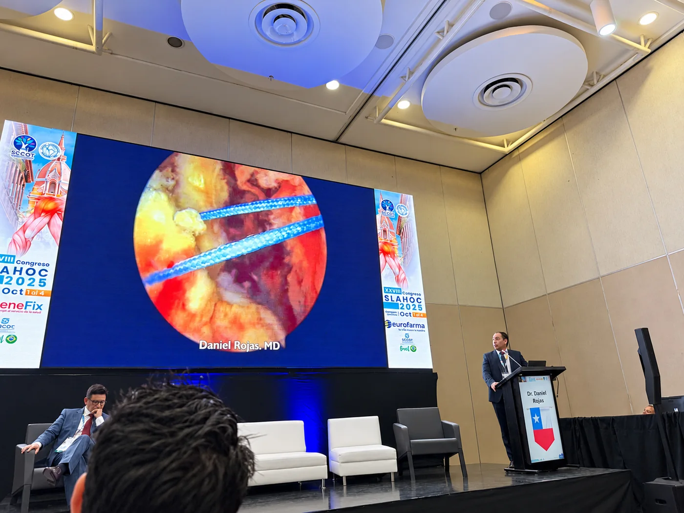 Dr. Daniel Rojas presenta un video de cirugía artroscópica en el módulo de manguito rotador del Congreso SLAHOC 2025